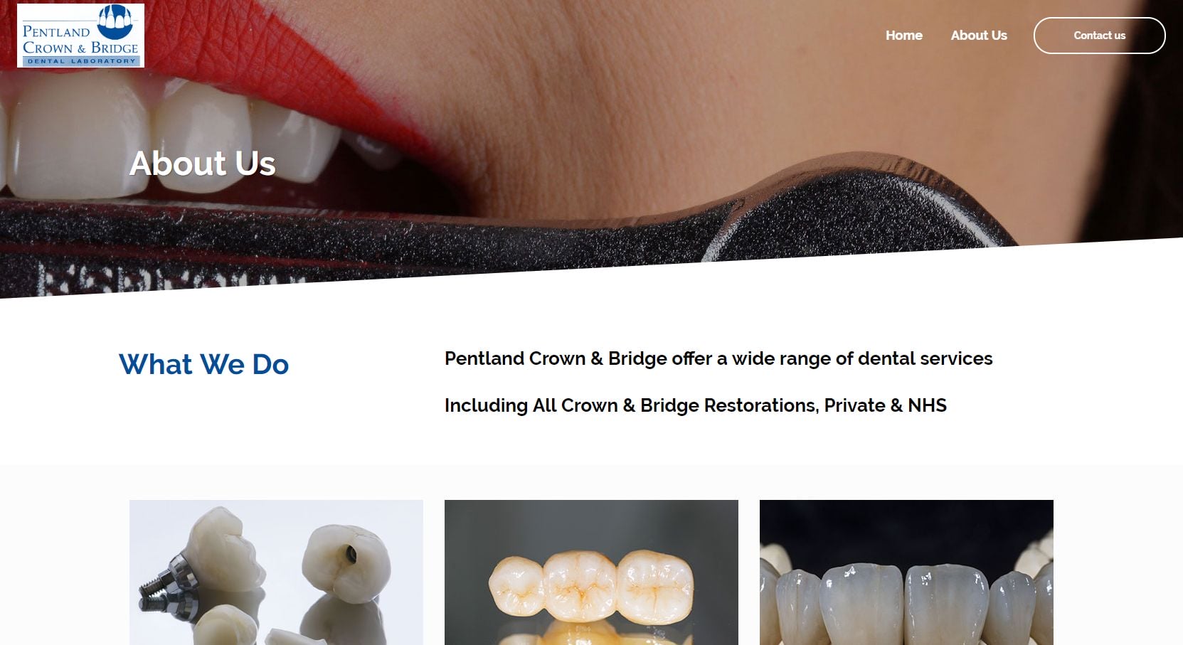 Pentland Crown & Bridge About
